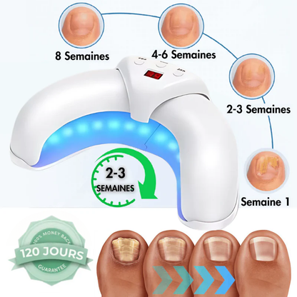 Sanooza™ - Votre chemin vers des ongles plus sains